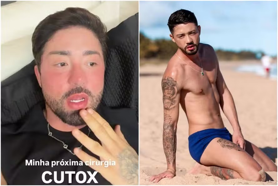 Rico Melquiades anunciou que pretende fazer harmonização anal