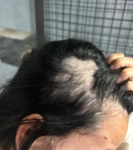 Mulher denuncia agressão por três servidoras públicas em festa junina no RJ
