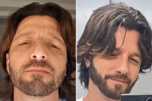 Um momento íntimo virou susto para Diogo Venturieri e Didy Reis após um acidente envolvendo um piercing no nariz do ator.