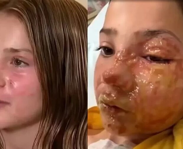 menina de 10 anos sofreu queimaduras graves apos aquecer um brinquedo sensorial no micro ondas e reproduzir uma tendencia viral vista nas redes sociais 1782312094028 v2 900x506.jpg