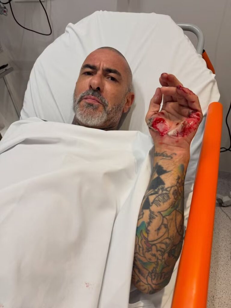 Jurado do MasterChef denunciou que sua aliança foi roubada no hospital
