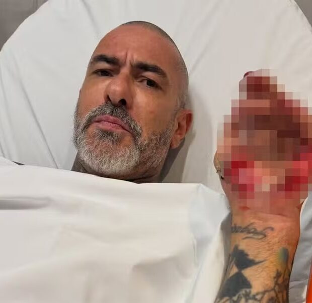 Henrique Fogaça revelou detalhes do acidente de moto sofrido em maio