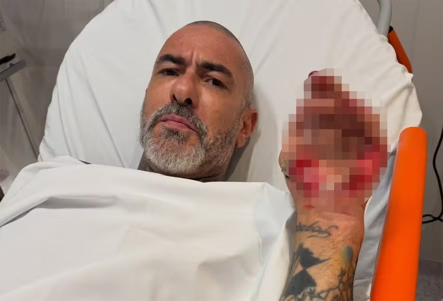 Henrique Fogaça revelou detalhes do acidente de moto sofrido em maio