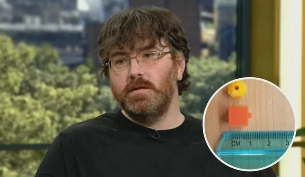 Michael Phillips diz ter o “menor pênis do mundo” e confirmou cirurgia íntima