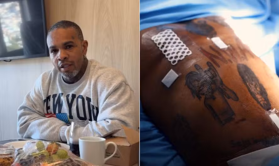 Após perder peso com mudança de hábitos, Rodriguinho realizou um procedimento para retirar o excesso de pele e mostrou detalhes do pós-operatório.