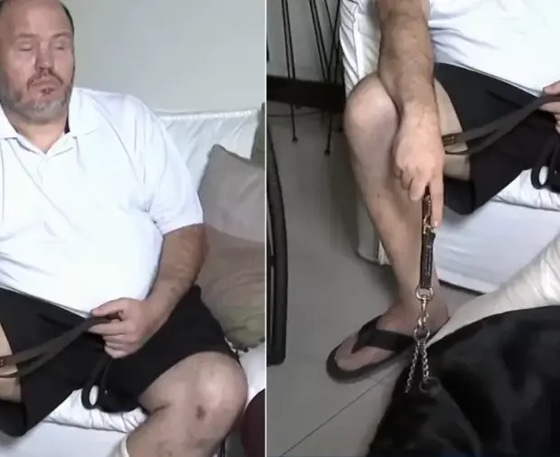 victor uchoa mostra machucados ao lado de cao guia 1784029083731 v2 900x506.png