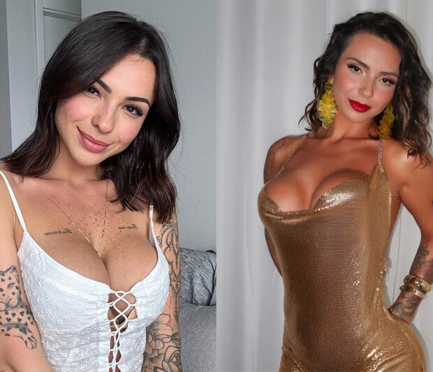 Karol Rosalin contou que não se reconheceu após aplicar botox.