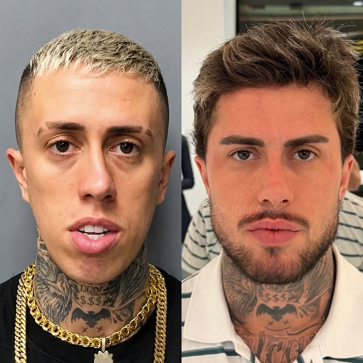 Antes e depois do MC Daniel