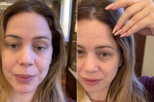 Leandra Leal mostrou os danos causados pela tintura usada em “Coração Acelerado”