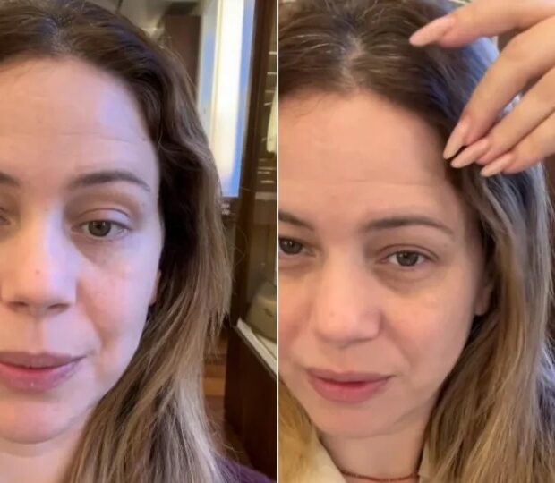 Leandra Leal mostrou os danos causados pela tintura usada em “Coração Acelerado”