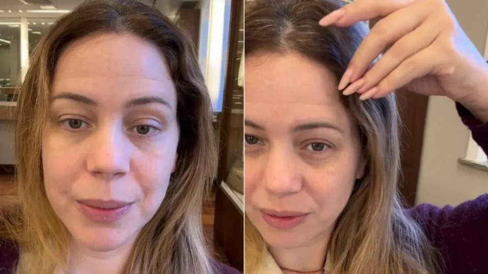 Leandra Leal mostrou os danos causados pela tintura usada em “Coração Acelerado”