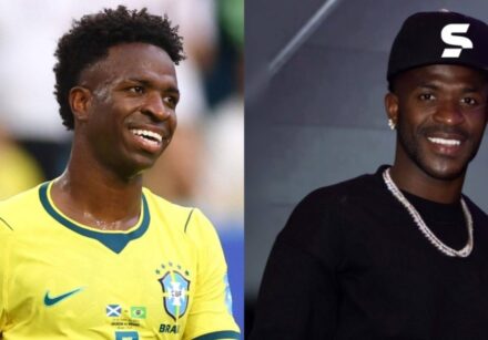 Vini Jr. passou por técnica chamada de “naturalização facial”