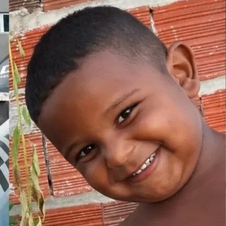 menino de 3 anos atingido por disparo de arma de pressão