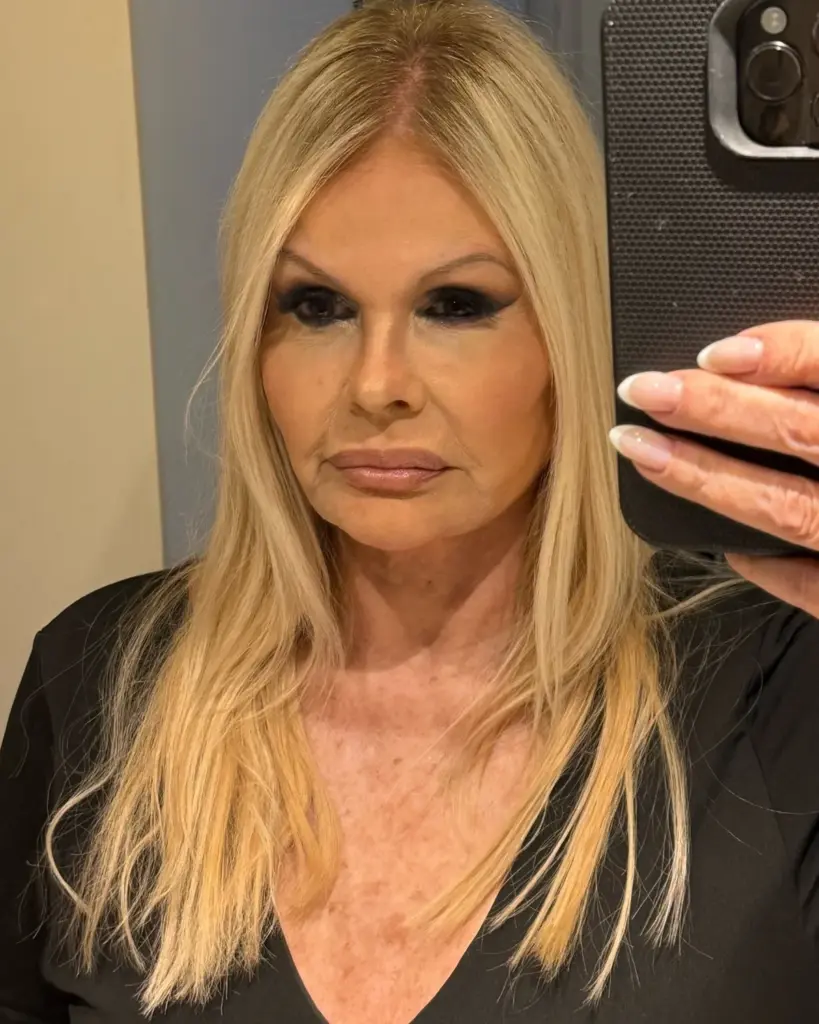 O inchaço do pós-operatório foi tanto que o sistema de reconhecimento facial do banco não identificou Monique Evans.
Créditos: Reprodução/Instagram