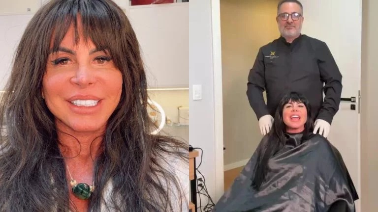 Gretchen afirmou que sofre com alopecia agressiva e quis incentivar outras mulheres que enfrentam perda de cabelo