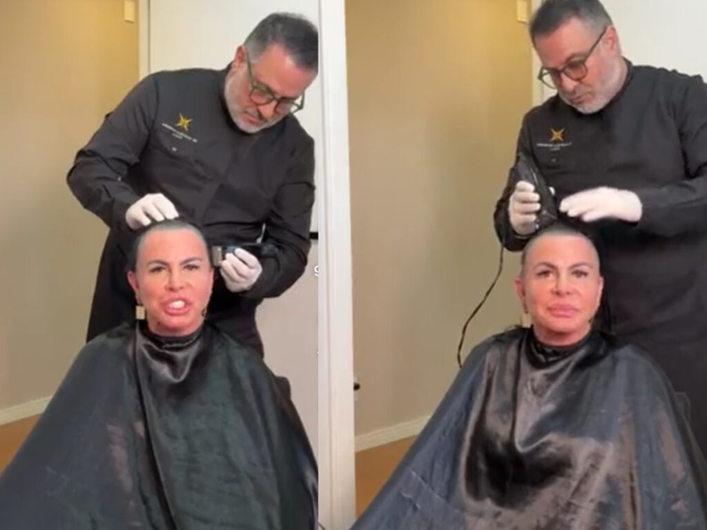 A cantora explicou que decidiu tirar todo o cabelo antes de passar por um transplante capilar

