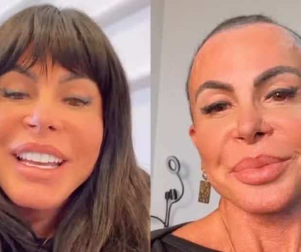 Gretchen apareceu careca após raspar a cabeça em transmissão ao vivo nas redes sociais