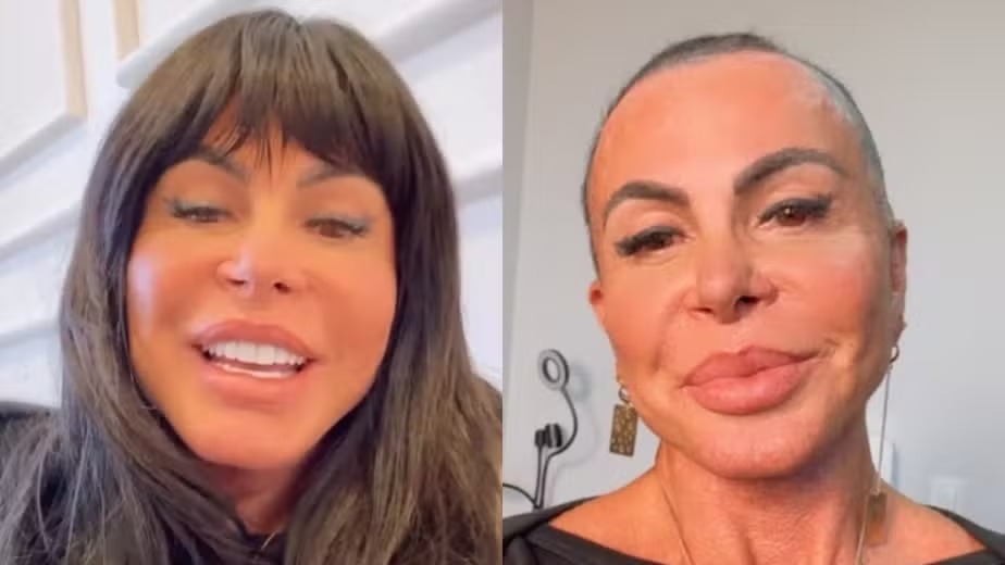 Gretchen apareceu careca após raspar a cabeça em transmissão ao vivo nas redes sociais