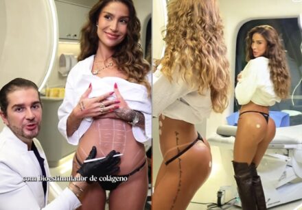 Bianca Andrade mostrou o resultado de procedimentos estéticos durante as férias e reacendeu o interesse por técnicas que valorizam firmeza e naturalidade.