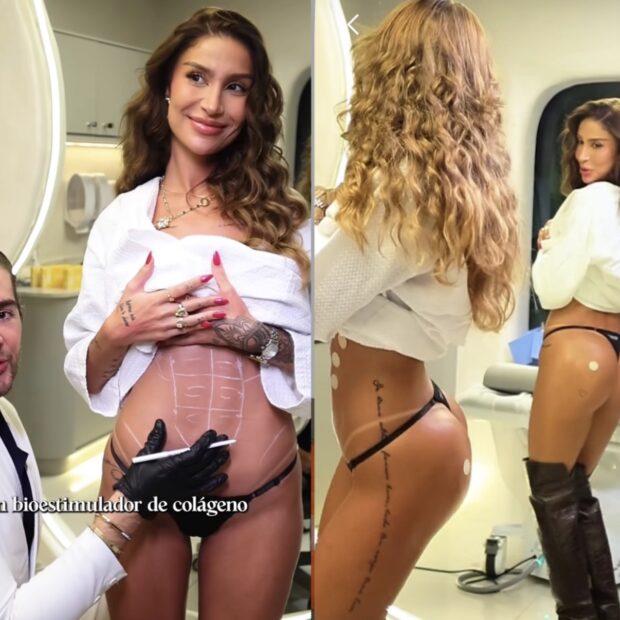 Bianca Andrade mostrou o resultado de procedimentos estéticos durante as férias e reacendeu o interesse por técnicas que valorizam firmeza e naturalidade.