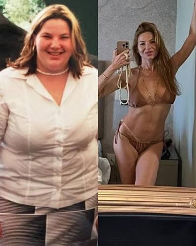 Jornalista falou sobre bariátrica, perda de mais de 70 kg e mudanças no tratamento que recebeu após emagrecer