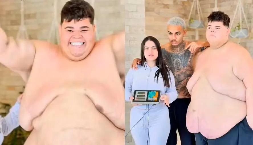 Sidney Bezerra chegou a pesar 345 kg e já perdeu 130 kg sem cirurgia bariátrica
