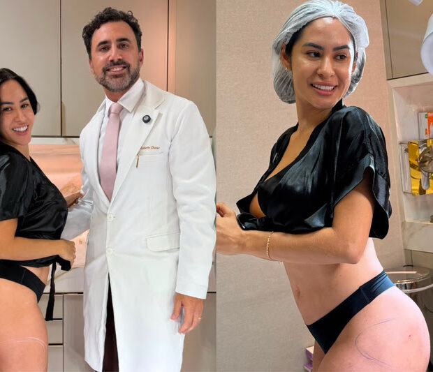 Isabelle Nogueira colocou 40 ml de ácido hialurônico de cada lado do bumbum com Roberto Chacur, médico que também cuida de Virgínia Fonseca. E o planejamento estético já tem próximos capítulos.