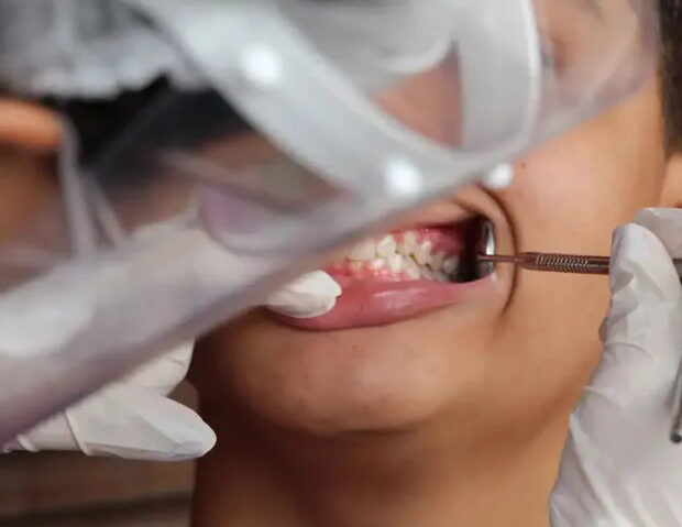 carie dentista