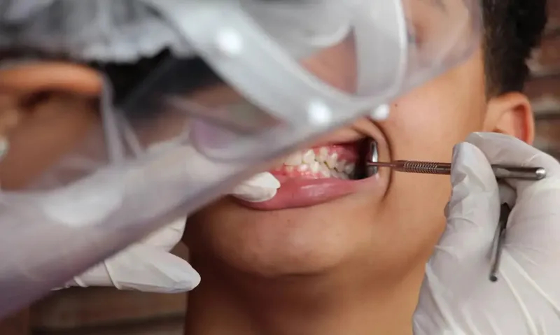 carie dentista