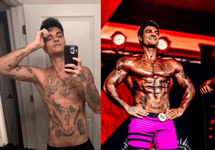 antes e depois 1