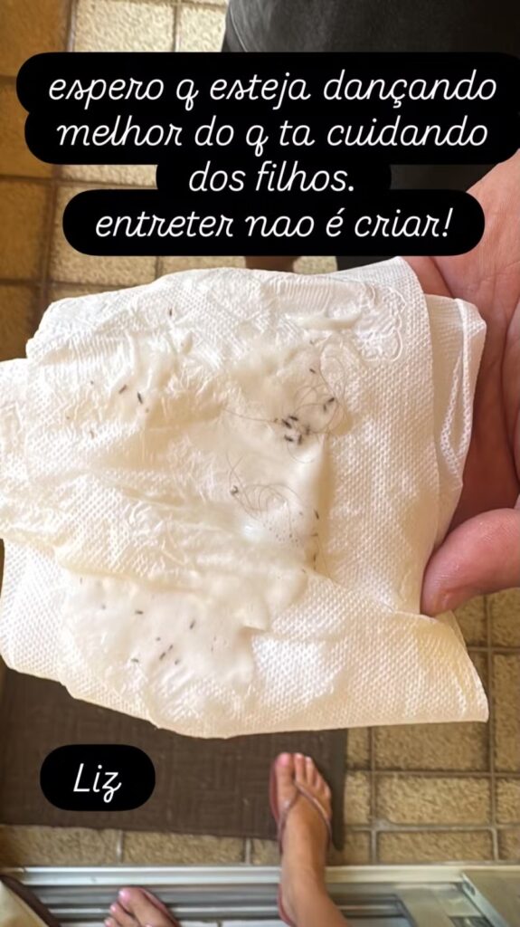 Luana Piovani mostrou piolhos que atribuiu à filha Liz nas redes sociais
