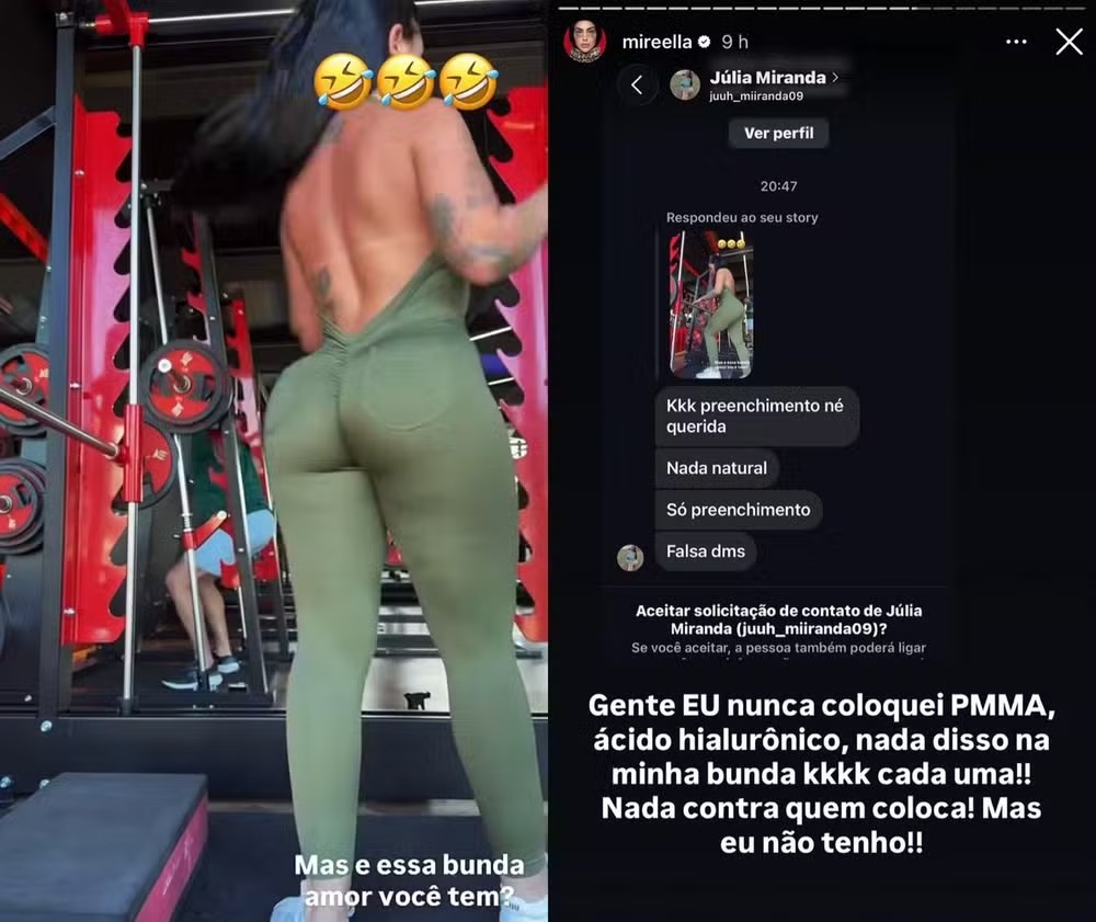 A funkeira afirmou que não usa PMMA ou ácido hialurônico nos glúteos.
