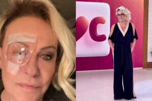 Ana Maria Braga apresentou o Mais Você após receber atendimento oftalmológico