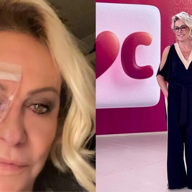 Ana Maria Braga apresentou o Mais Você após receber atendimento oftalmológico