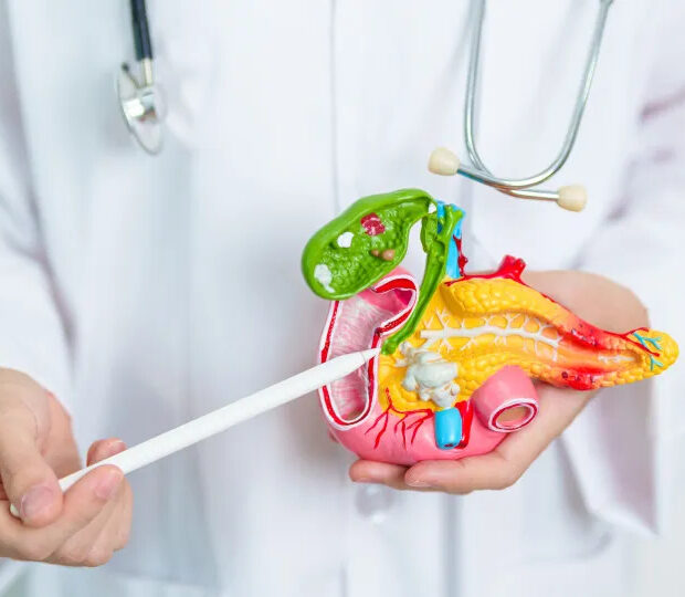 cancer de pancreas