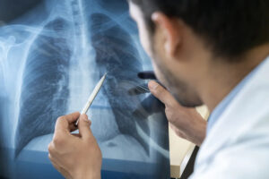 pneumonia