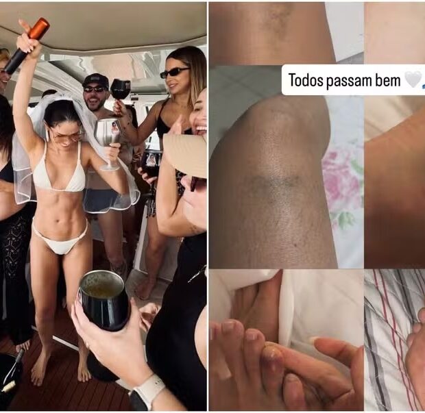 Juliette mostrou o dedo roxo após a despedida de solteira na Paraíba