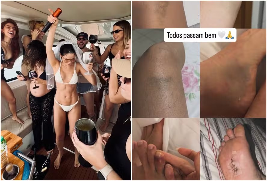 Juliette aparece machucada após despedida de solteira apocalíptica: “Confundiram com o fim do mundo”