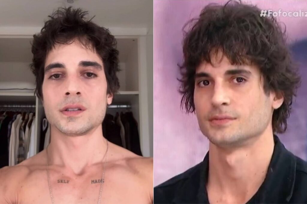 Fiuk mostrou o resultado da harmonização facial no Fofocalizando
