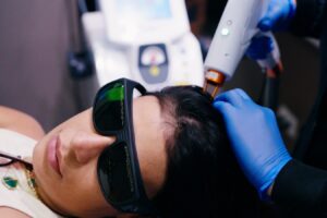 Simone Mendes aposta em novo protocolo capilar após enfrentar queda de cabelo Divulgação/Thiago Bianco
